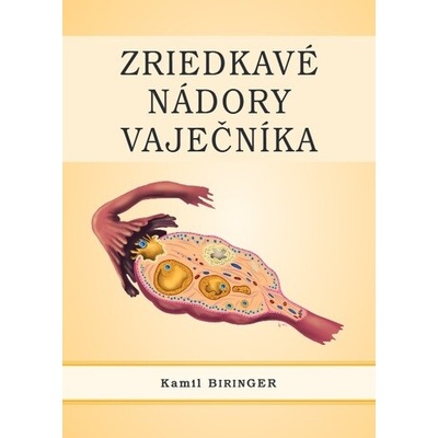 Zriedkavé nádory vaječníka - Kamil Biringer