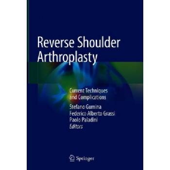 Reverse Shoulder Arthroplasty