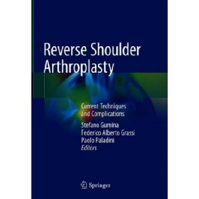 Reverse Shoulder Arthroplasty