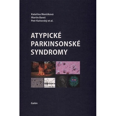 Atypické parkinsonské syndromy - Kateřina Menšíková; Martin Bareš; Petr Kaňovský - 2015