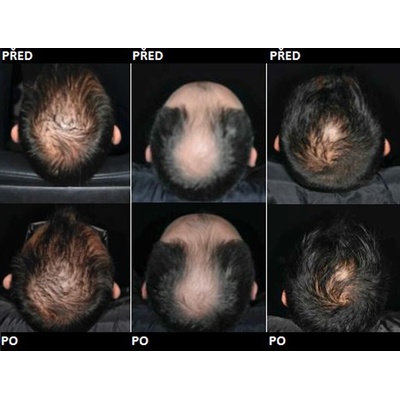 FacEvolution Hair Stim Capsules na posilnenie vlasov 30 tabliet
