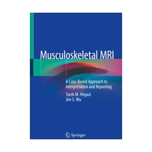 Musculoskeletal MRI | Tarek Hegazi, Jim S. Wu (ISBN: 9783030267766)