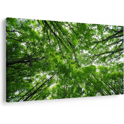 Obraz - Pohled do korun stromů, jednodílný 150x100 cm
