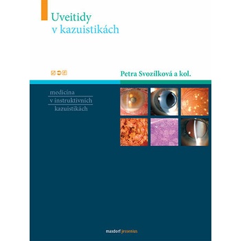 Uveitidy