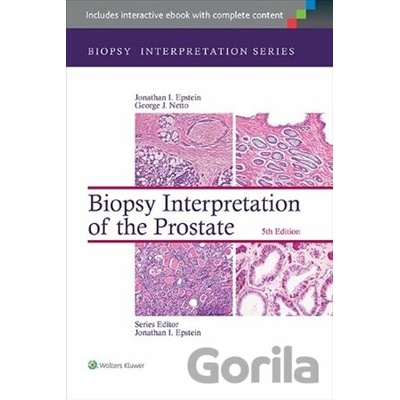 Biopsy Interpretation of the Liver Torbenson Michael MDPevná vazba