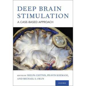 Deep Brain Stimulation | Shilpa Chitnis, Pravin Khemani, Michael S. Okun (ISBN: 9780190647209)