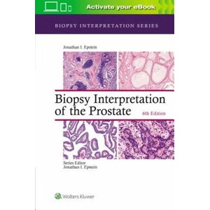 Biopsy Interpretation of the Prostate (ISBN: 9781975136543)