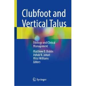 Clubfoot and Vertical Talus | Matthew B. Dobbs, Ashok N. Johari, Mitzi Williams (ISBN: 9783031347863)