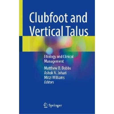 Clubfoot and Vertical Talus | Matthew B. Dobbs, Ashok N. Johari, Mitzi Williams