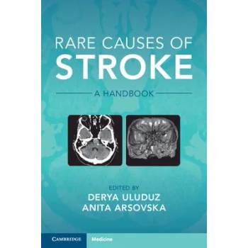 Image 1 of Rare Causes of Stroke | Derya Uluduz, Anita Arsovska