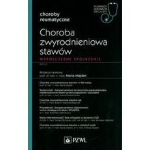 Choroba zwyrodnieniowa stawów