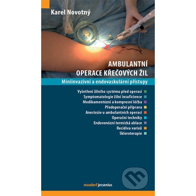 Ambulantní operace křečových žil