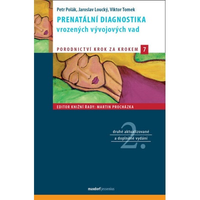 Prenatální diagnostika vrozených vývojových vad - Jaroslav Loucký, Petr Polák, Viktor Tomek