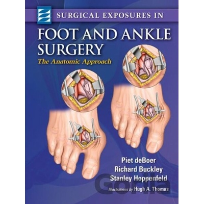 Surgical Exposures in Foot & Ankle Surgery