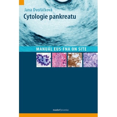 Cytologie pankreatu - Dvořáčková Jana