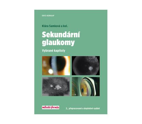 Sekundární glaukomy