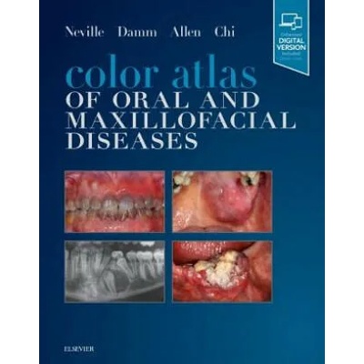 Color Atlas of Oral and Maxillofacial Diseases | Neville, Brad W. , DDS, Douglas D. Damm, Carl M. Allen, Angela C. Chi