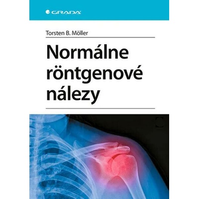 Normálne röntgenové nálezy