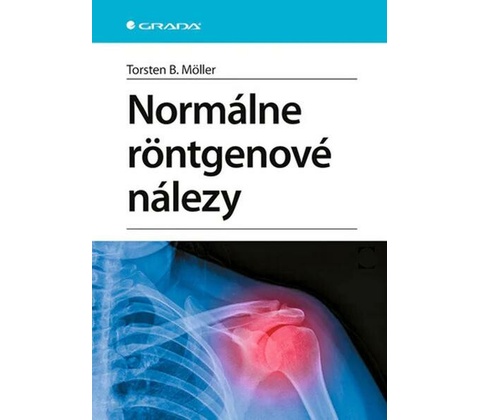Normálne röntgenové nálezy