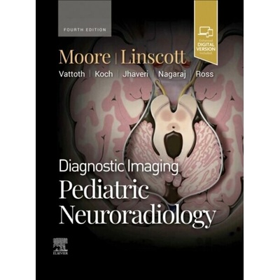 Diagnostic Imaging Pediatric Neuroradiology - Kevin R. Moore, Luke L. Linscott