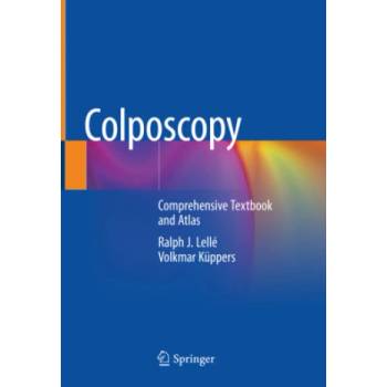 Colposcopy: Comprehensive Textbook and Atlas | Ralph J. Lellé, Volkmar Küppers