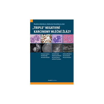 Kolečková, Markéta; Vomáčková, Katherine - „Triple“ negativní karcinomy mléčné žlázy