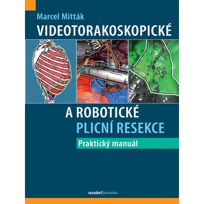 Videotorakoskopické a robotické plicní resekce - Marcel Mitták