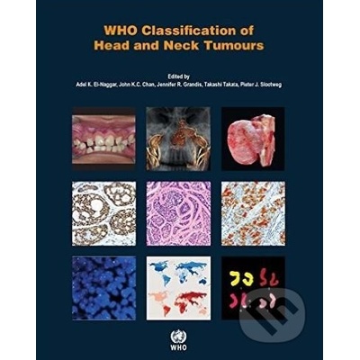 WHO Classification of Head and Neck Tumours El-Naggar Adel K.Paperback
