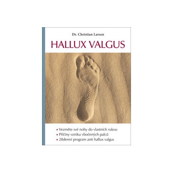 Hallux valgus
