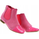 Dětské nazouvací boty lakované 6331