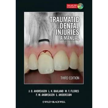 Image 1 of Traumatic Dental Injuries - A Manual 3e | Jens O Andreasen