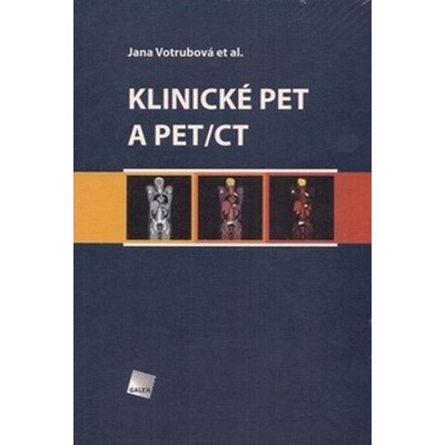 Klinické PET a PET/CT - Jana Votrubová