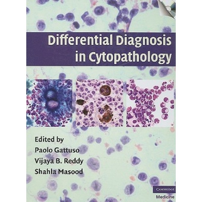 Differential Diagnosis in Cytopathology - Paolo Gattuso, Vijaya B. Reddy, Shahla Masood