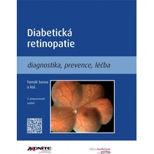 Diabetická retinopatie - Tomáš Sosna, kol.