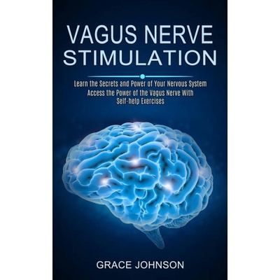Vagus Nerve Stimulation