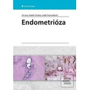 Endometrióza
