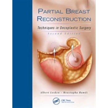 Partial Breast Reconstruction