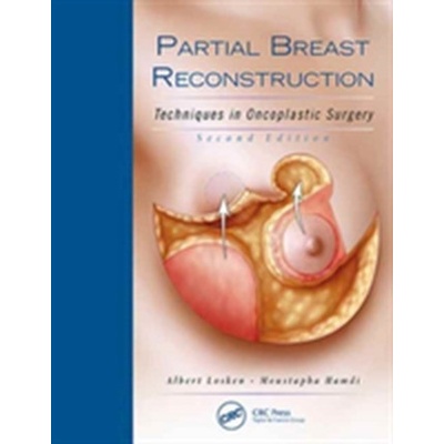 Partial Breast Reconstruction