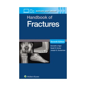 Handbook of Fractures: Print + eBook with Multimedia | EGOL, KENNETH A (ISBN: 9781975217990)