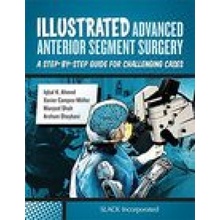 Illustrated Advanced Anterior Segment Surgery