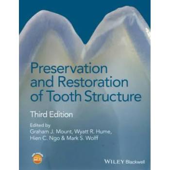Image 1 of Preservation and Restoration of Tooth Structure 3e | Graham J. Mount