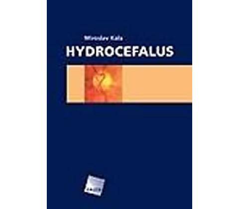 Hydrocefalus