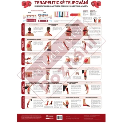 Plagát Terapeutické tejpovanie 70 x 48cm