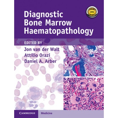 Diagnostic Bone Marrow Haematopathology Book with Online content | JON VAN DER WALT