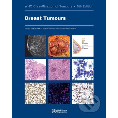 Who Classification of Tumours: Breast Tumours -