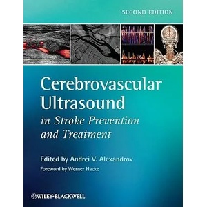 Cerebrovascular Ultrasound in Stroke Prevention and Treatment 2e | Andrei V Alexandrov (2011)