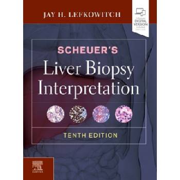 Scheuer's Liver Biopsy Interpretation