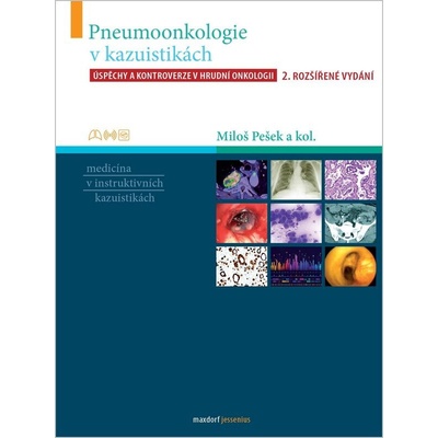 Pneumoonkologie v kazuistikách - Úspěchy a kontroverze v hrudní chirurgii