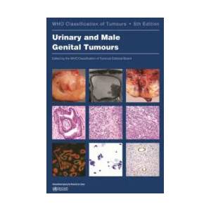 Urinary and Male Genital Tumours | WHO CTEB (ISBN: 9789283245124)