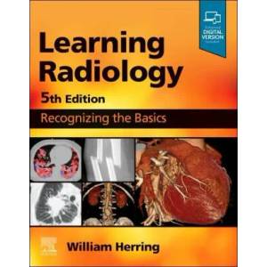 Learning Radiology (ISBN: 9780323878173)